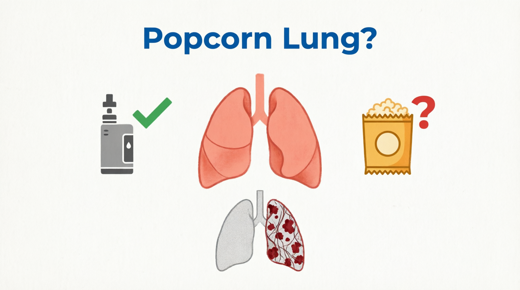 Vaping, Diacetyl, and Popcorn Lung: Is the Threat Real?